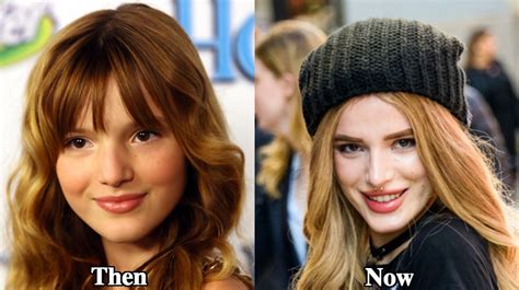 Bella Thorne’s Plastic Surgery – What We Know So Far